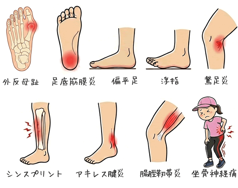 足部痛イラスト