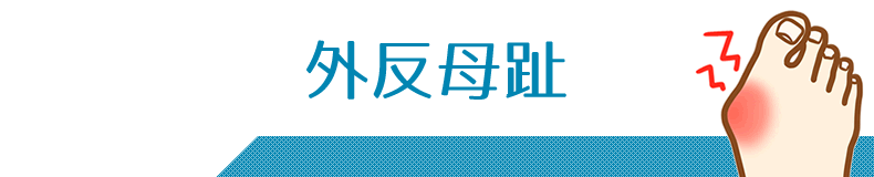 外反母趾