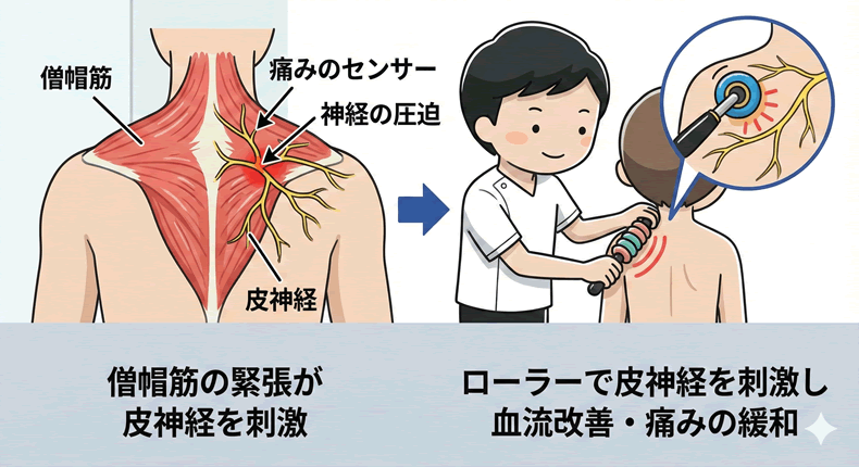肩こり・首こりの原因となる筋肉の血流をとりもどす