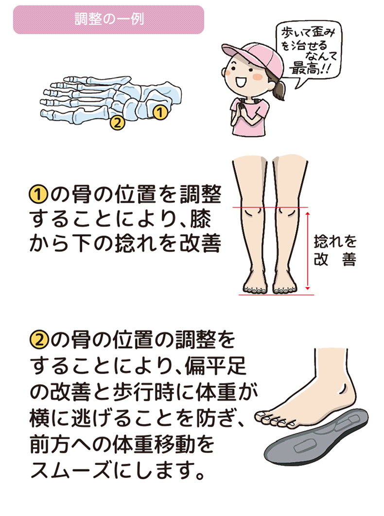 育てるインソール